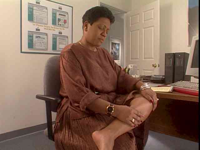 This woman has the early warning signs of high pressure in her leg veins.